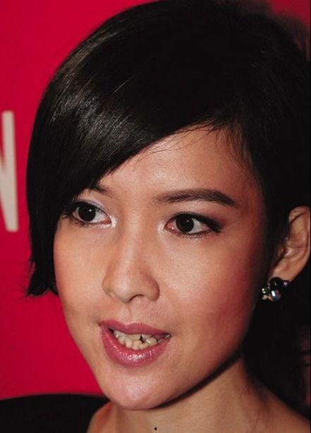 明星丑牙,从笑不露齿到自信微笑的蜕变之路